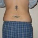2 months after smart lipo - back